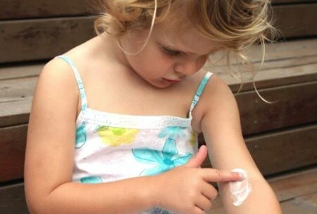 View Childhood Eczema