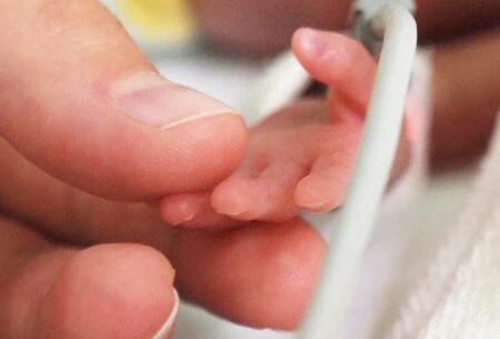 View Preterm Nutrition