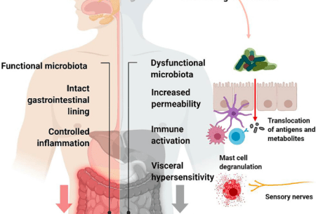 View Our evolving understanding of IBS Illustrated image of upper body highlighting areas of gut function