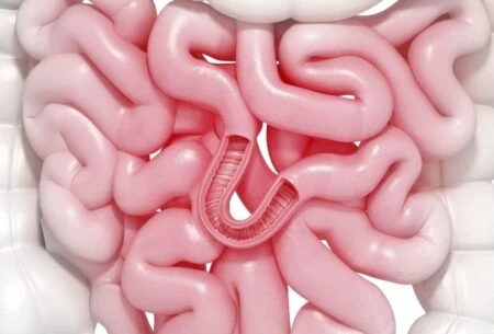 View Get to Know Small Intestinal Bacterial Overgrowth (SIBO)