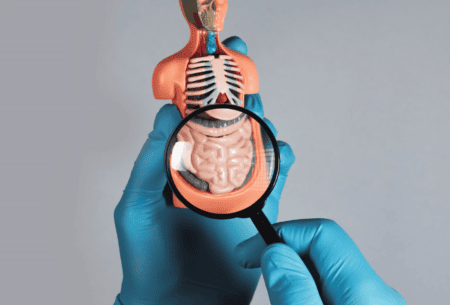 View Bowel Strictures & Adhesion